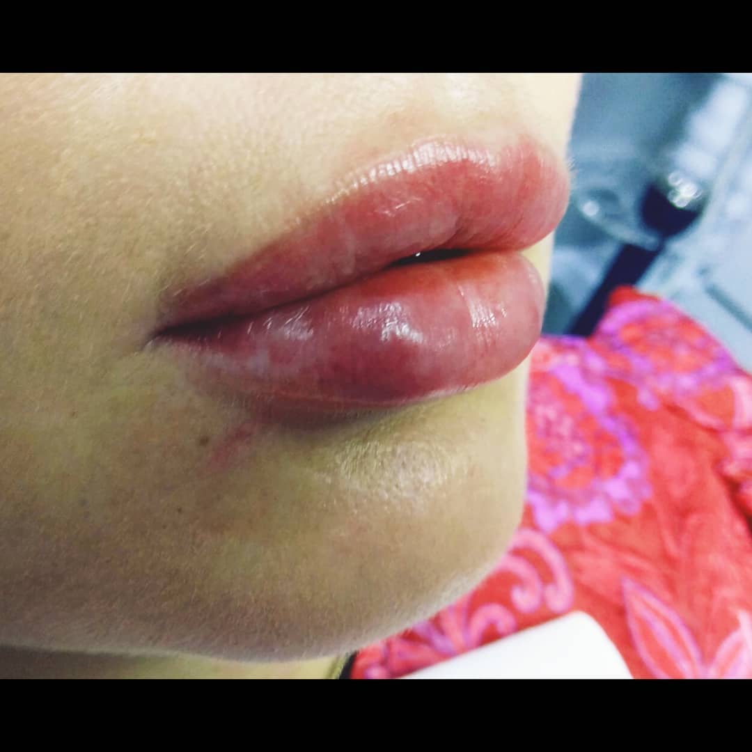 Style Age Special Lips

Usta