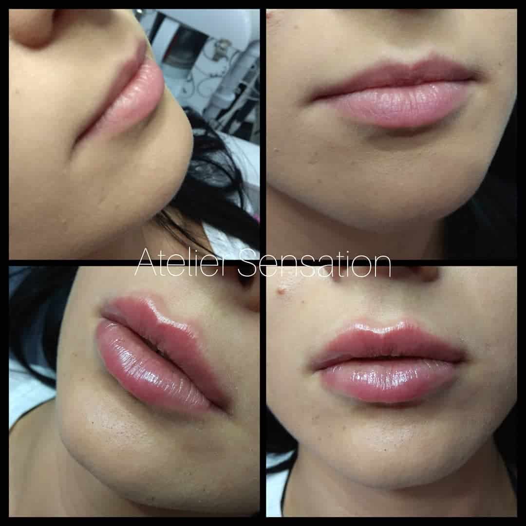 Lips Lips