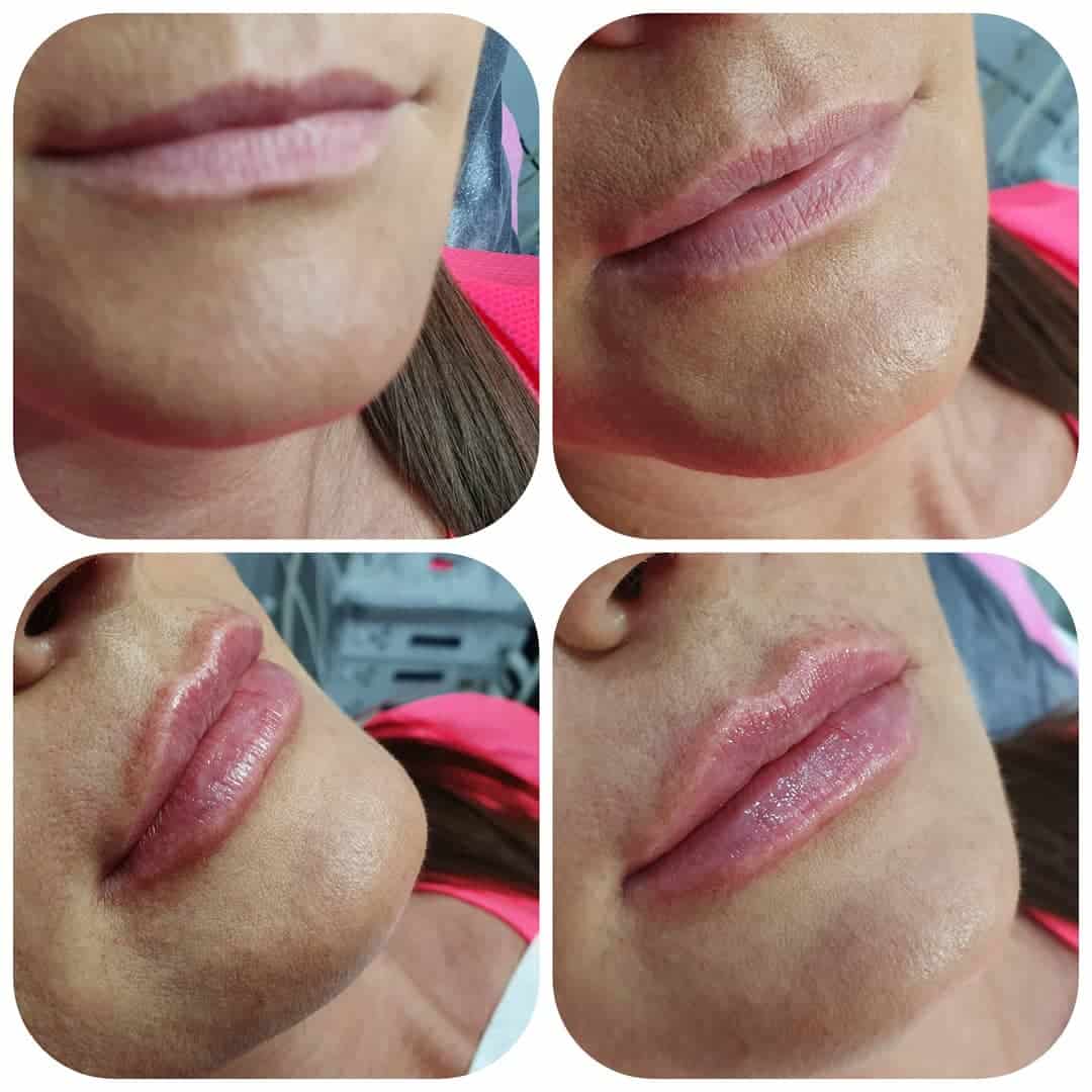 Lipslipslips

1ml StylAge Special Lips

Wyk.Joanna

Usta