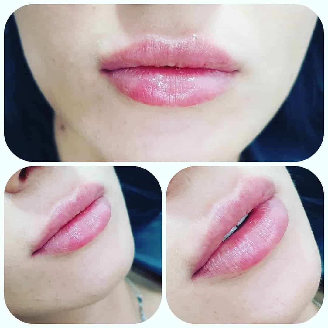 Baby lips 0,5 ml

Lips
